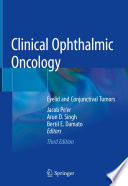 Clinical Ophthalmic Oncology : Eyelid and Conjunctival Tumors /
