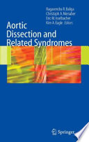 Aortic dissection and related syndromes