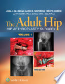 The adult hip : hip arthroplasty surgery.