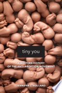 Tiny you : a western history of the anti-abortion movement /