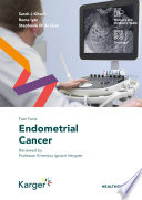Endometrial cancer /